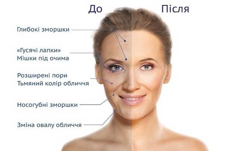 Причины нездорового цвета лица, как улучшить – продукты, витамины, уход