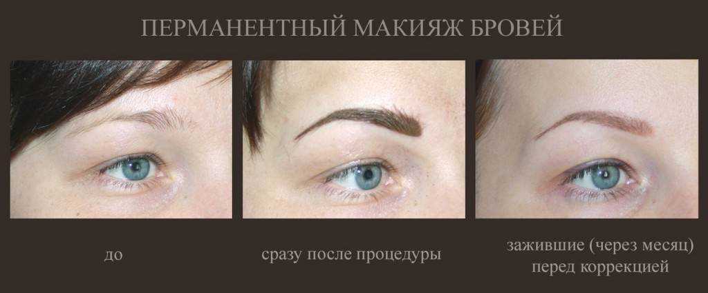 Коррекция перманентного макияжа бровей. как происходит заживление, уход