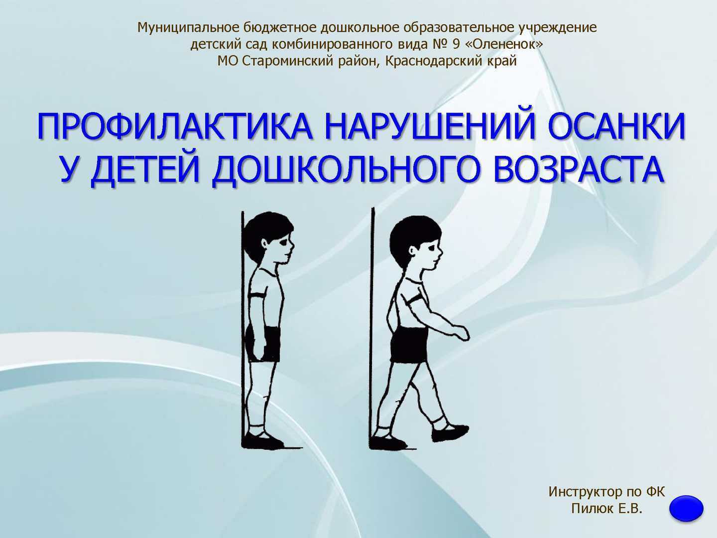 Нарушение осанки у детей и взрослых, профилактика, взаимосвязь с плоскостопием и сколиозом