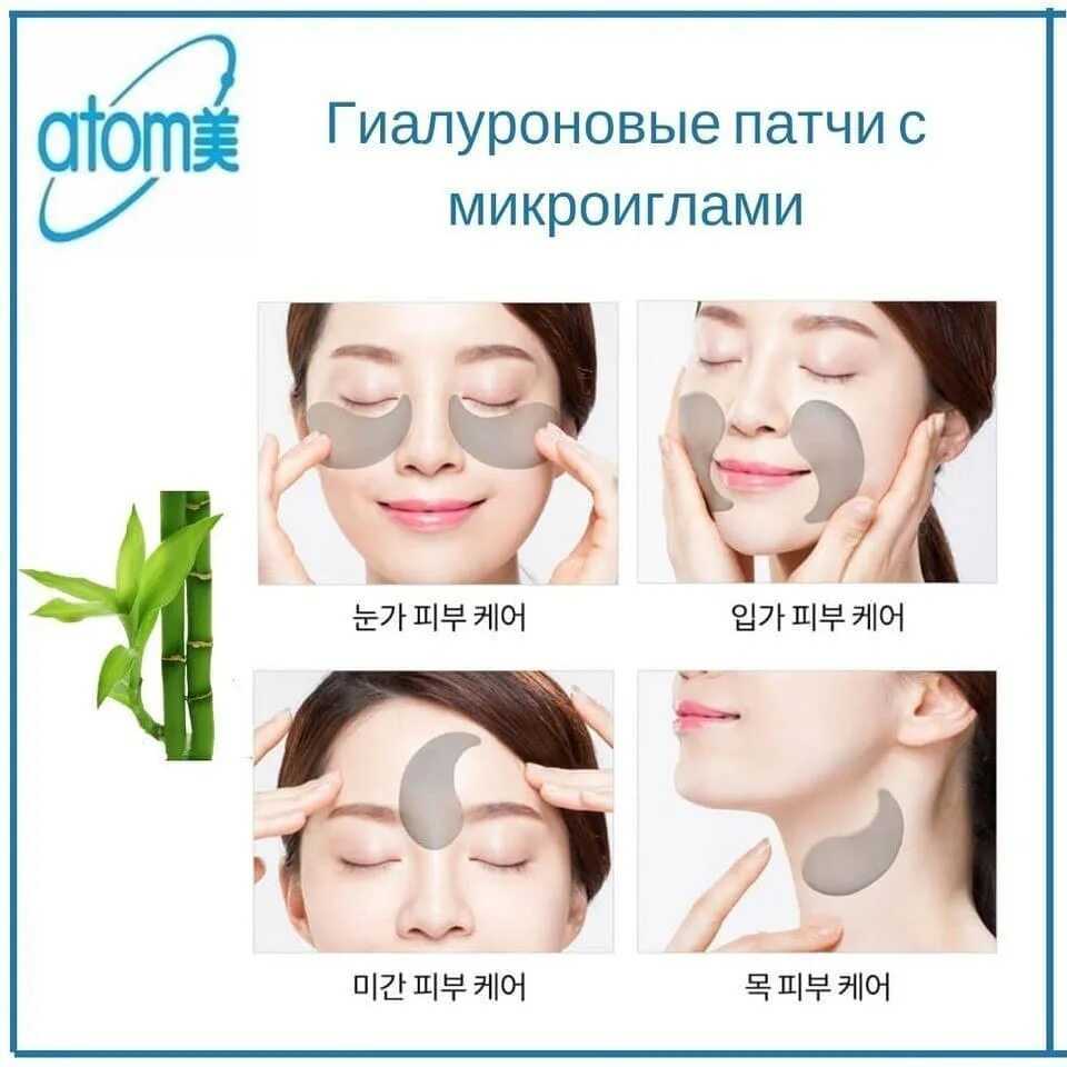 Микроиглотерапия продленного действия