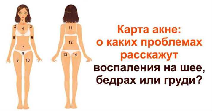 Прыщи на лице и психоэмоциональные нарушения | гель азелик
