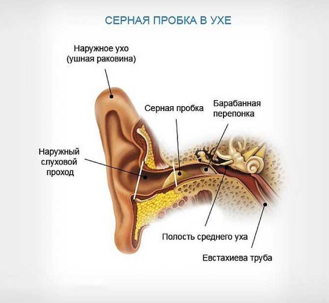 Как чистить ушки новорожденному, грудному ребенку: видео об уходе за ушами