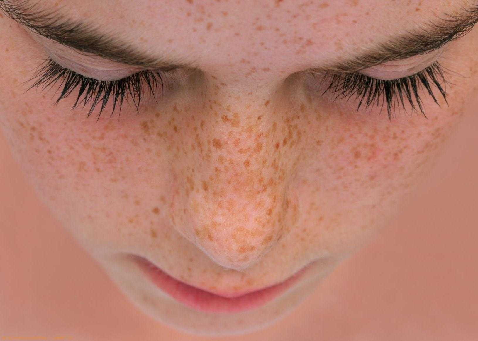 Как сделать веснушки на лице: 5 простых способов