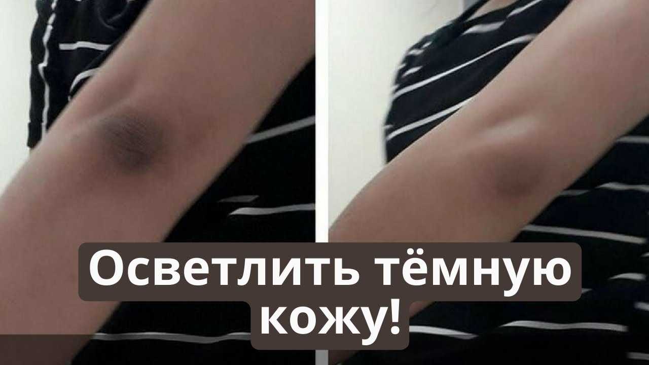 Как отбелить локти пищевой содой - лучшие хитрости
