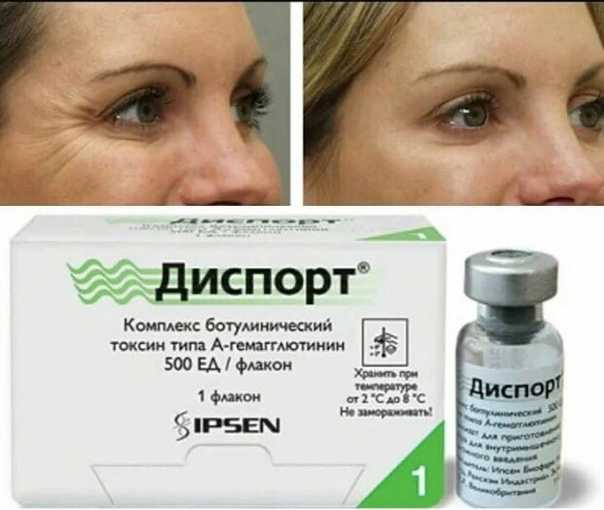 Все о препарате диспорт производство состав как проходит процедура показания противопоказания сравнение с ботоксом и ксеомином Ограничения которые возникнут если решиться на процедуру с инъекциями диспорта