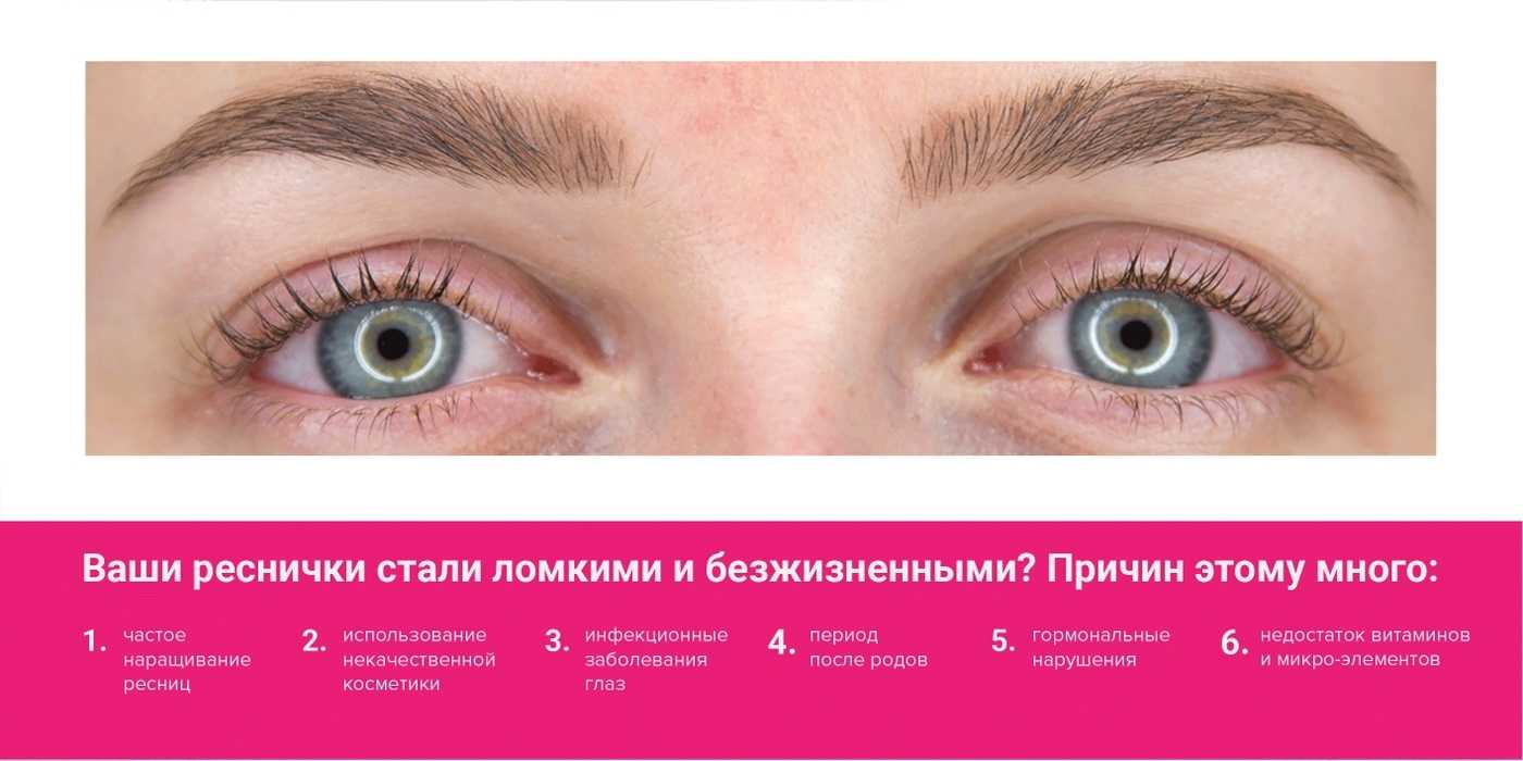 Уход за ресницами: масла, маски, косметические средства и процедуры