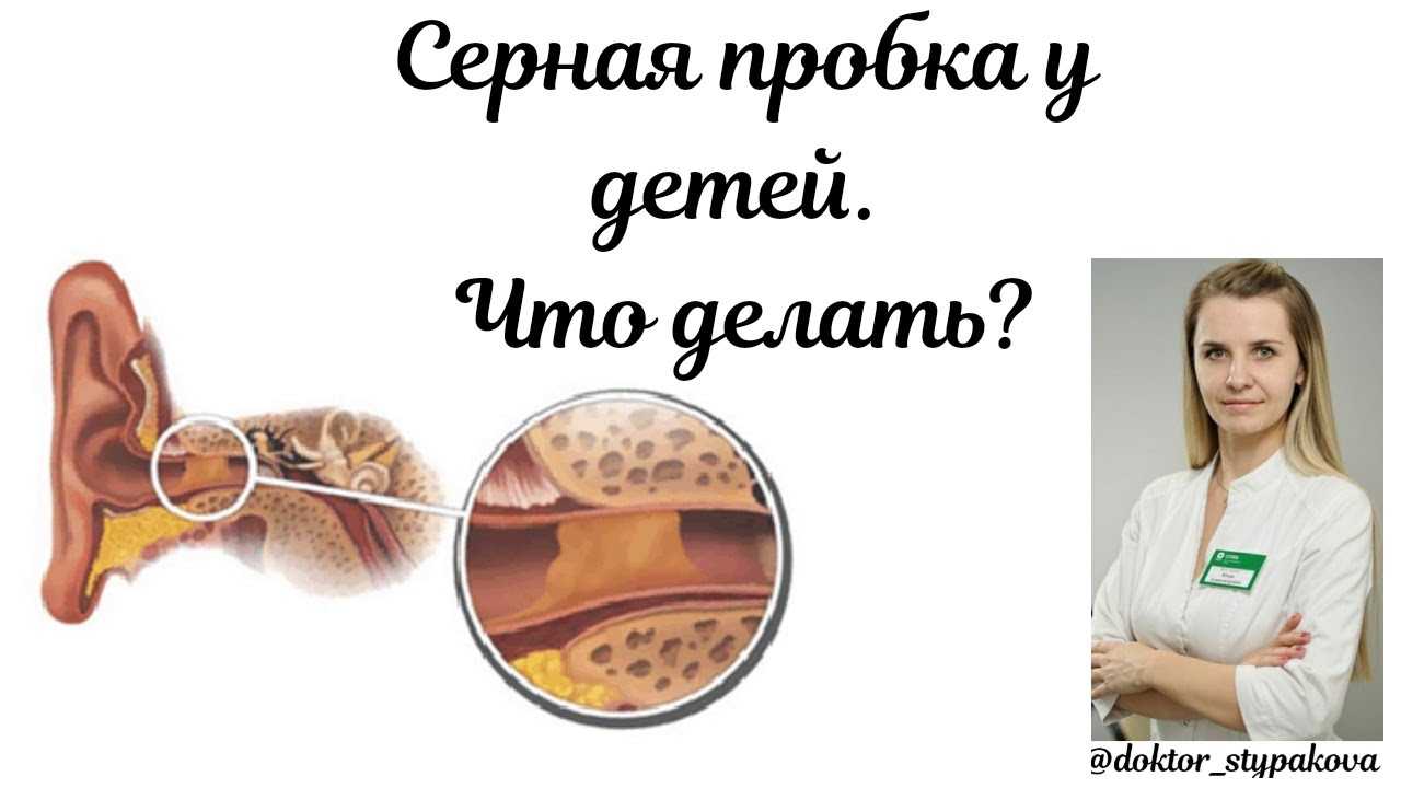 Как чистить уши новорожденному