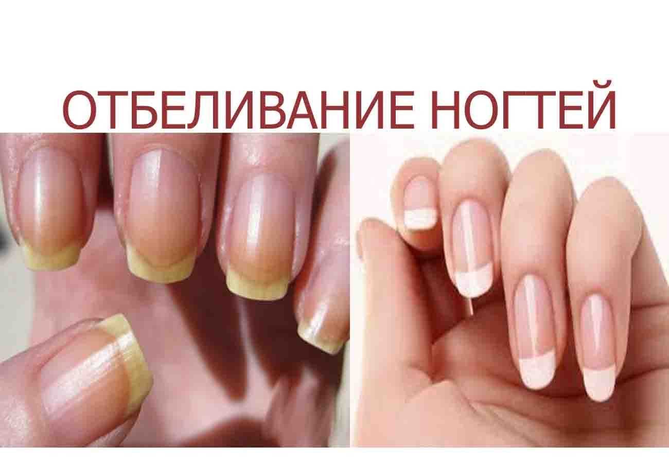 Рассказываем как очистить ногти от грязи быстро и эффективно лучшие домашние способы лайфхаки и советы по уходу за ногтевой пластиной