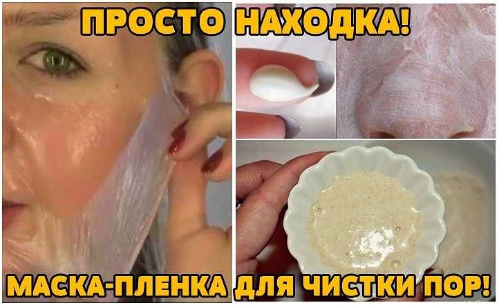 Как избавиться от расширенных пор