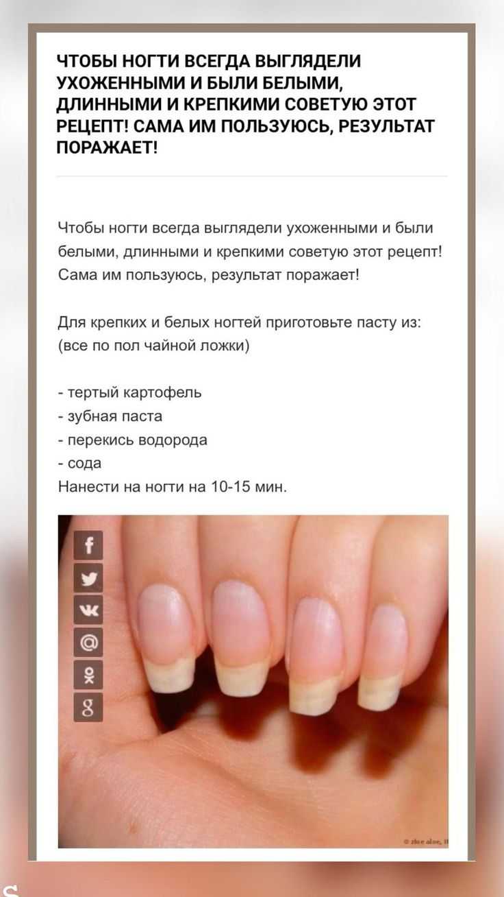 Как отрастить длинные ногти в домашних условиях, причины ломкости