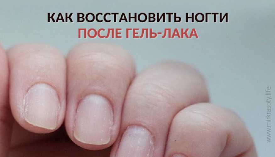 Чем лечить аллергию на шеллак?