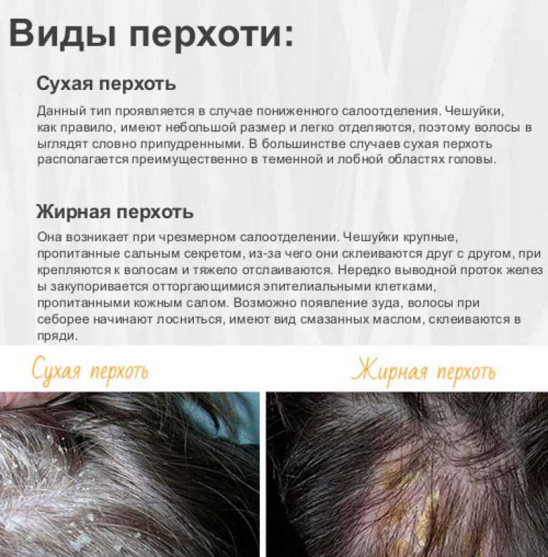 Почему после обработки от вшей чешется голова | паранит