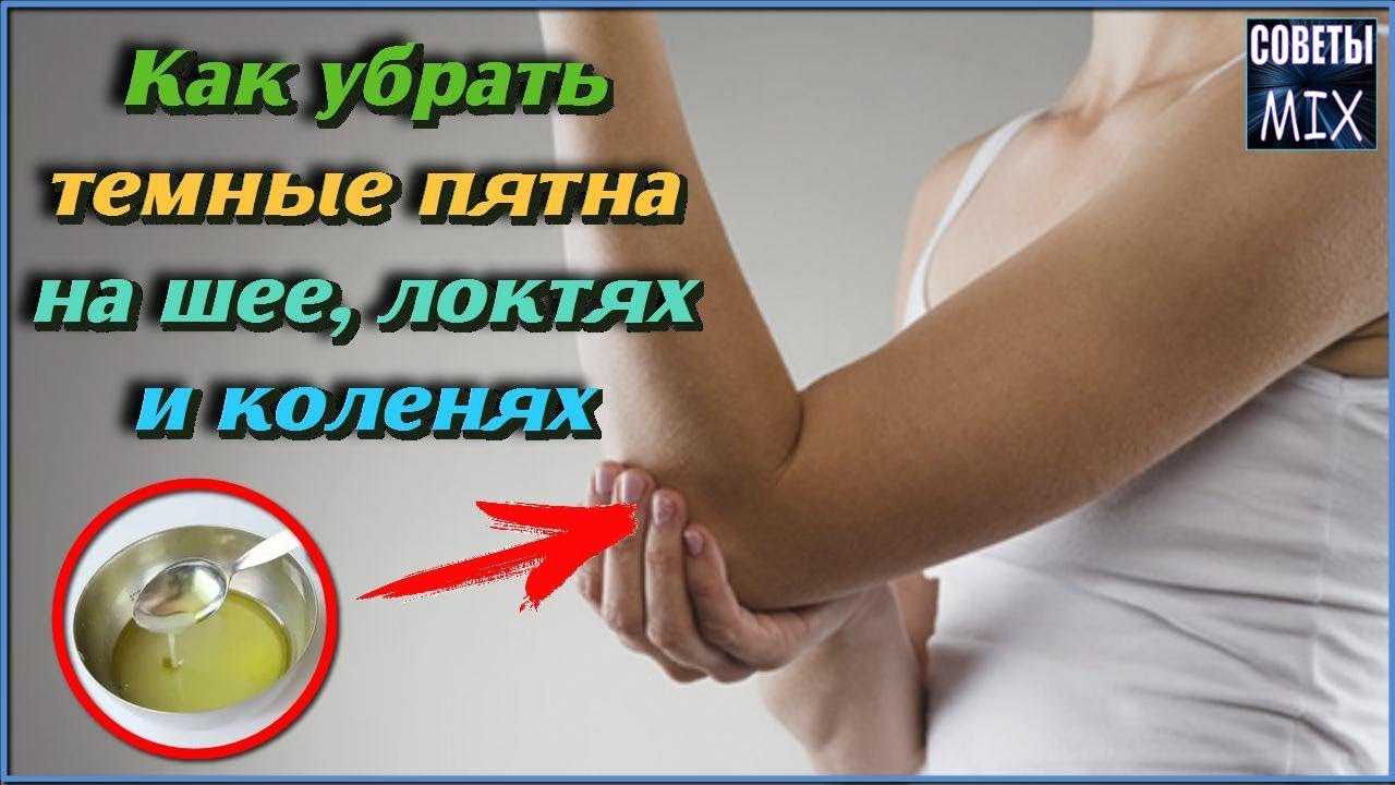 Что делать и как лечить шершавые локти? домашние маски и народные средства от черных локтей