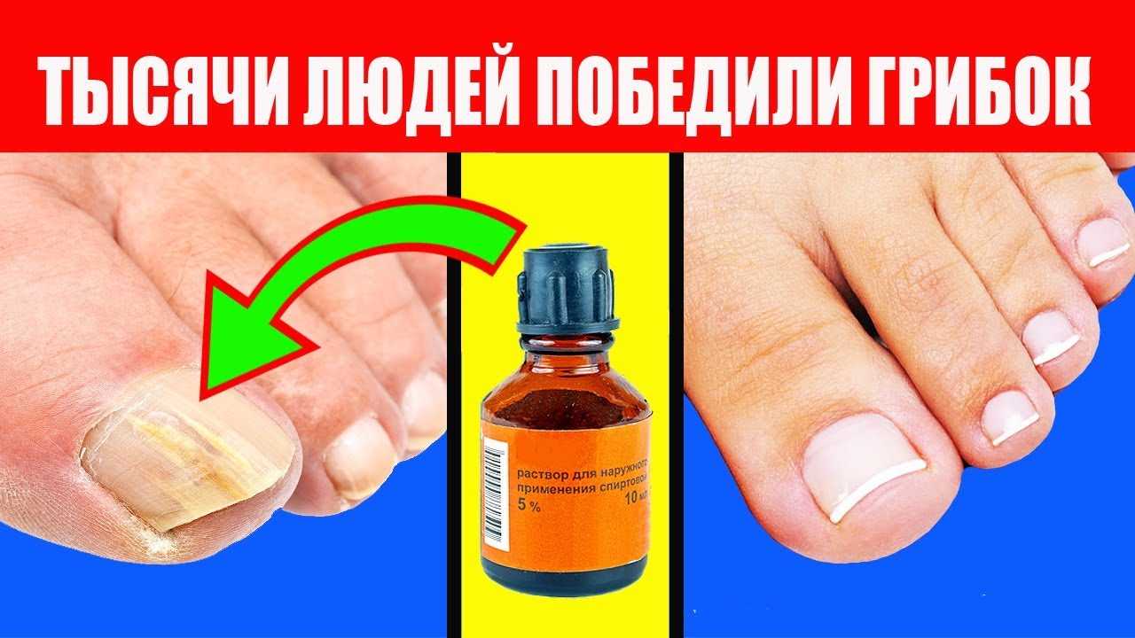 Как можно продезинфицировать обувь