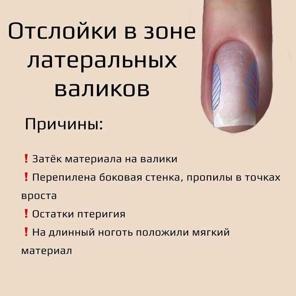 Для чего предназначено базовое покрытие в маникюре и советы по выбору баз