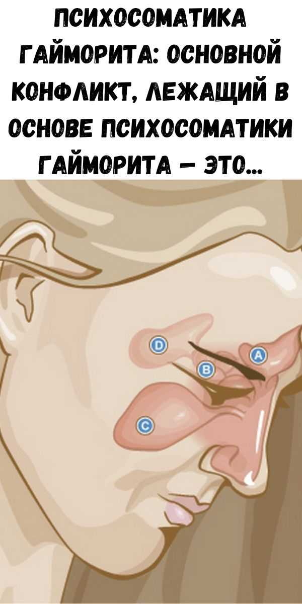 Психосоматика заложенности носа и насморка