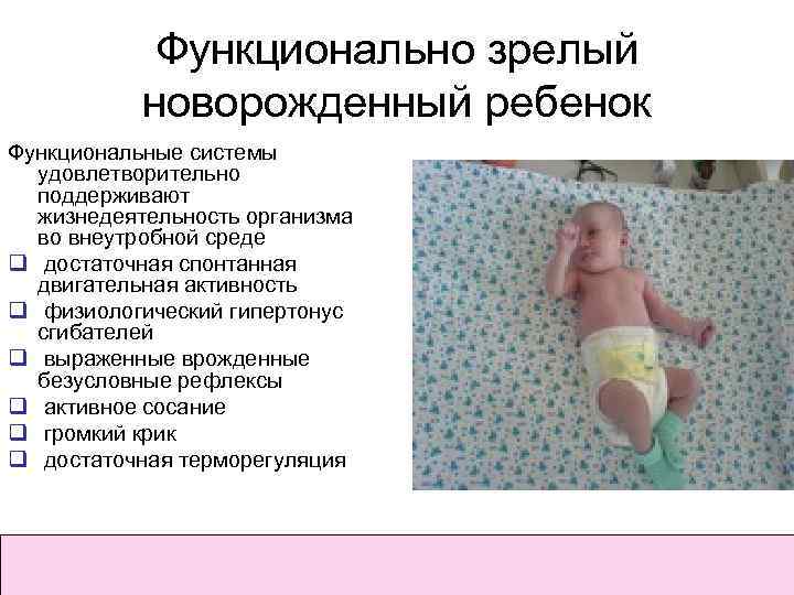 Гипертонус мышц у новорожденных и младенцев до года: симптомы и лечение у грудничков