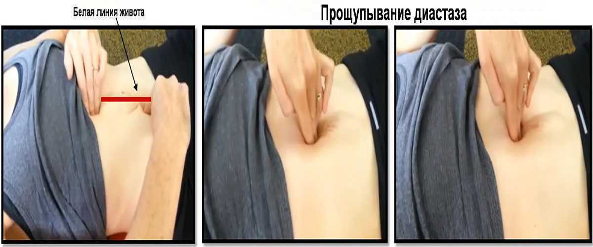 Выпирает живот: причины вздутого и надутого живота, почему выпирает низ, что делать, если сама худая, а большой животик торчит - как его убрать?
