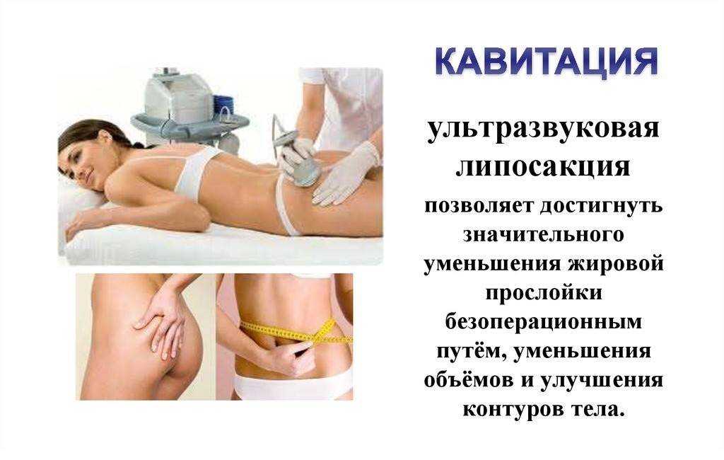 Lpg-массаж тела - что это, противопоказания, эффект— секреты красоток