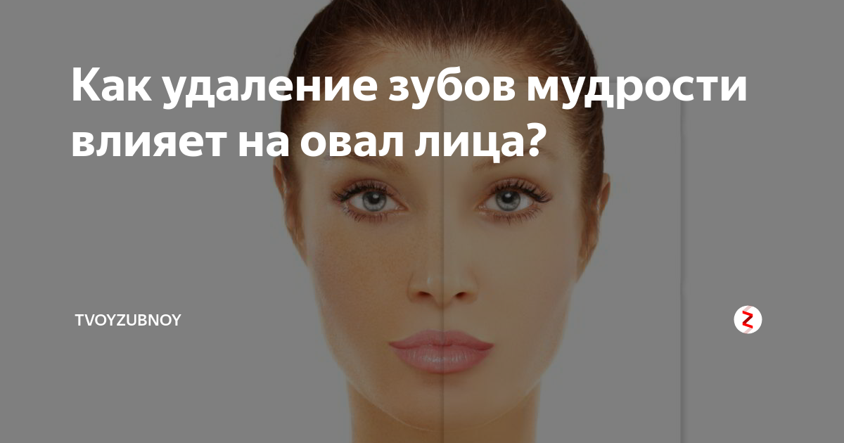 10 знаменитостей, чья потрясающая улыбка на самом деле легальна (& 10, у которых был действительно хороший стоматолог) / развлекательная программа | советы и полезная информация об отношениях и браке.